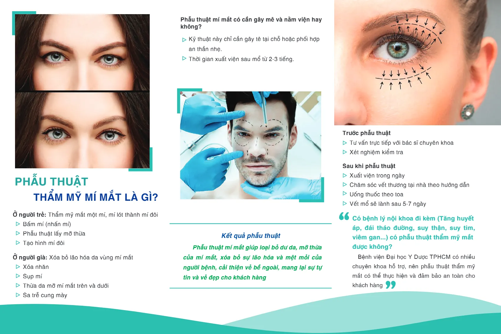 to roi phau thuat tham my my mat la gi_2.webp